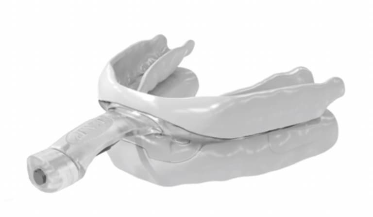 Best Anti-Snoring Mouthpieces and Mouthguards - Best for Back Sleepers - Airway Management myTAP Oral Appliance