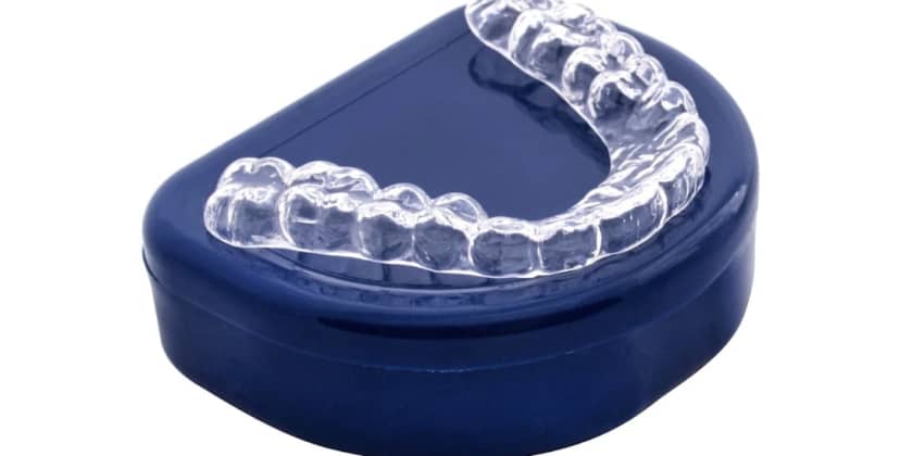 Best Mouthguards for Teeth Grinding: Find Your Perfect Fit - Best for Severe Grinding - JS Dental Lab Hard Shield